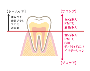 ホームケアとプロケア